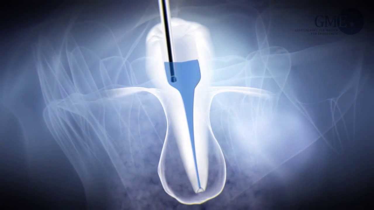 endodontologie-dr-lackner